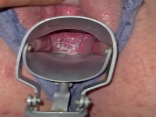 Milky cervix: volný vysoká rozlišením x jmenovitý video video 2c